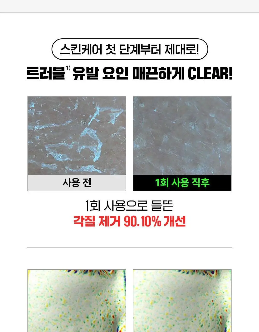 [약산성/저자극] 파티온 노스카나인 트러블 클리어 토너 200ml 상세페이지 13